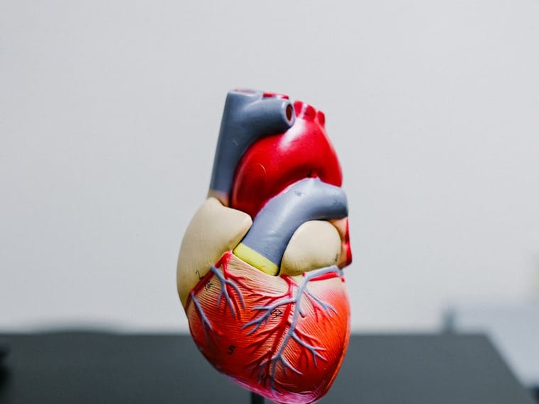 Anatomical model of a human heart